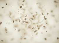 Dust & Pet Dander